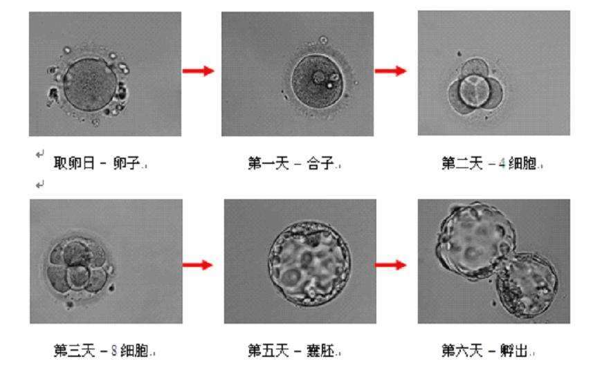 试管婴儿移植后的20个正常反应，遇上了别慌