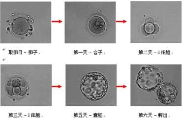 试管婴儿移植后的20个正常反应，遇上了别慌