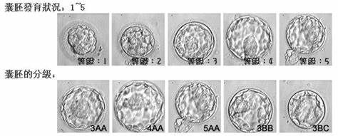 教你如何快速识别试管婴儿胚胎等级