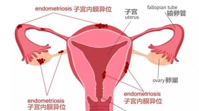 试管婴儿三代技术各有其适用范围，并不是越高越好