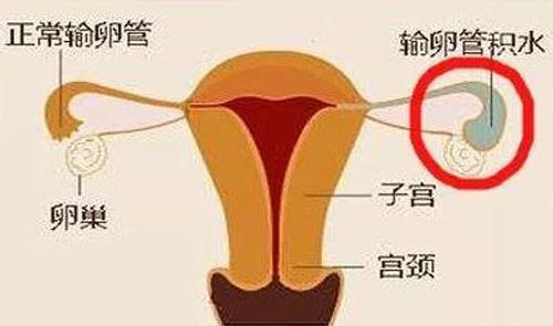 做试管婴儿时只要避开这些陷阱，胚胎着床成功