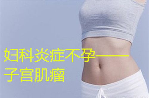 妇科炎症不孕—子宫肌瘤